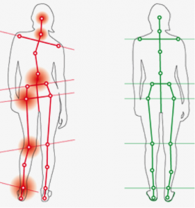 OPS-LAST-281×300 Examen clinique